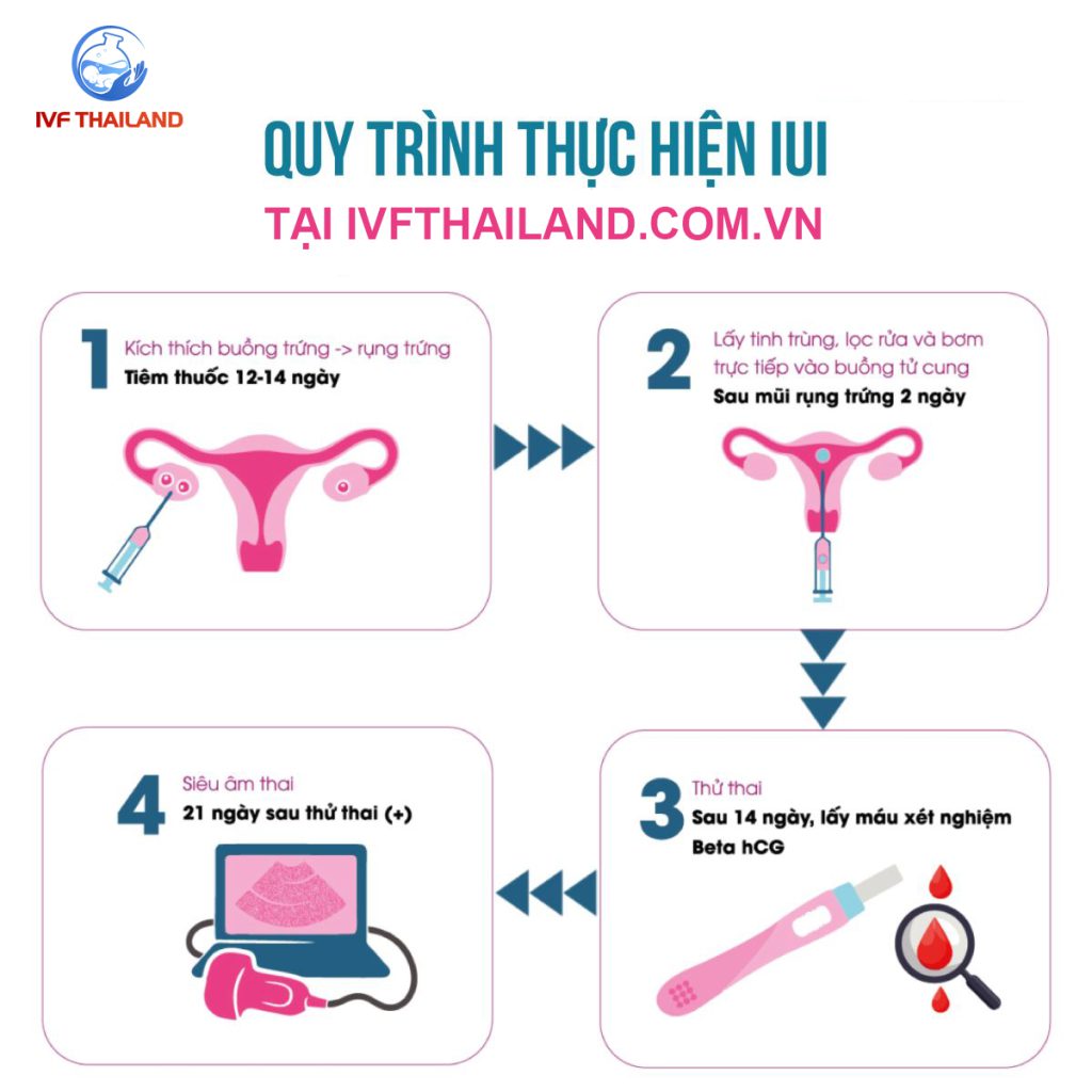 quy trinh iui tai thai lan