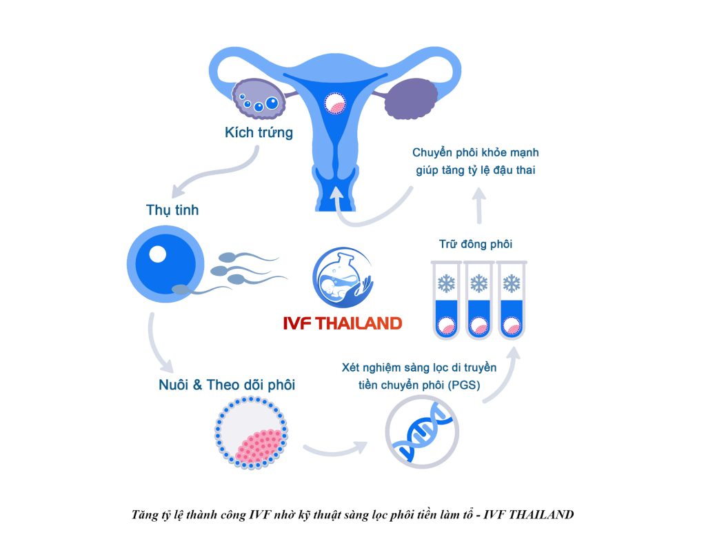 Tăng tỷ lệ thành công IVF nhờ kỹ thuật sàng lọc phôi tiền làm tổ