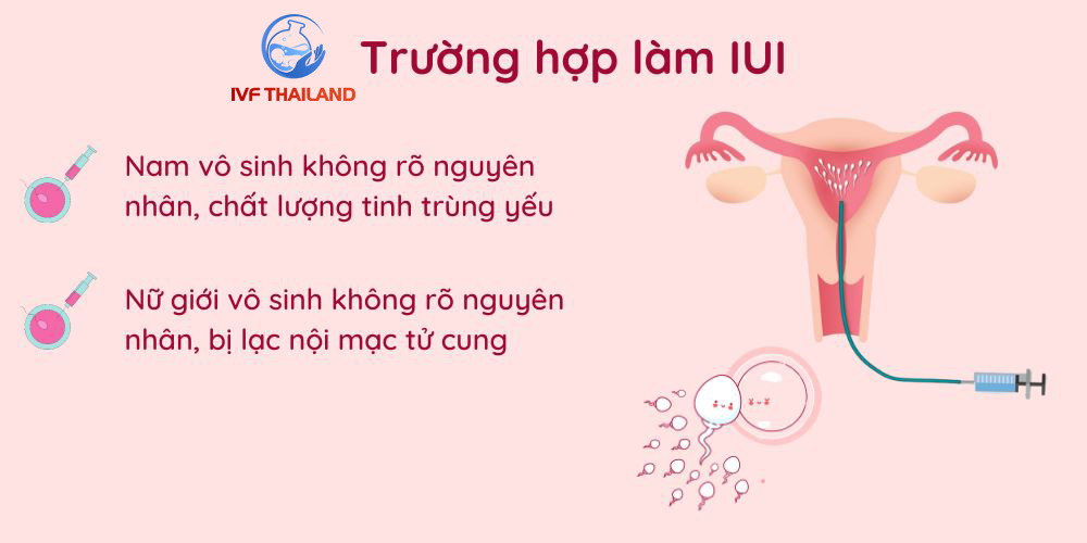 trường hợp làm iui-kinh nghiệm làm iui tai thai lan