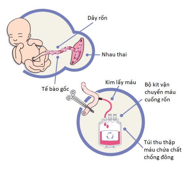 ivf tai Thai lan