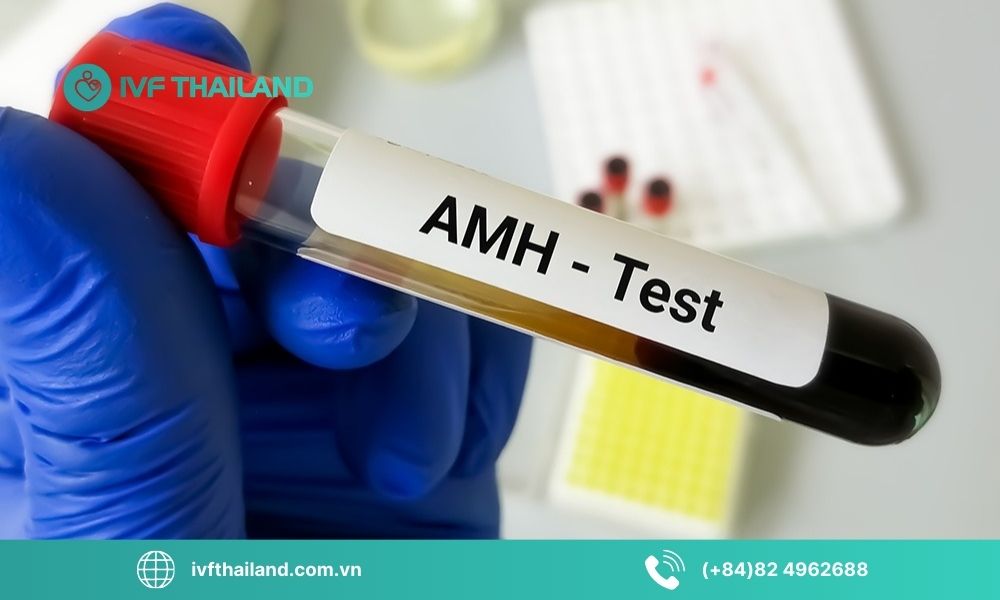 AMH là gì? Chỉ số bao nhiêu được xem là thấp?