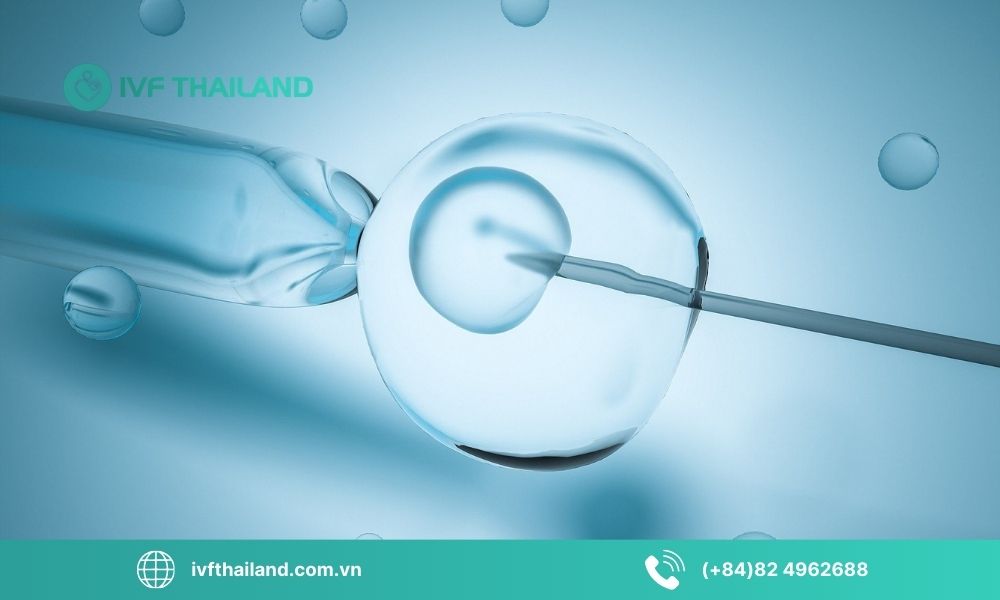 Điều kiện trứng và buồng trứng cần đạt trước khi làm IUI