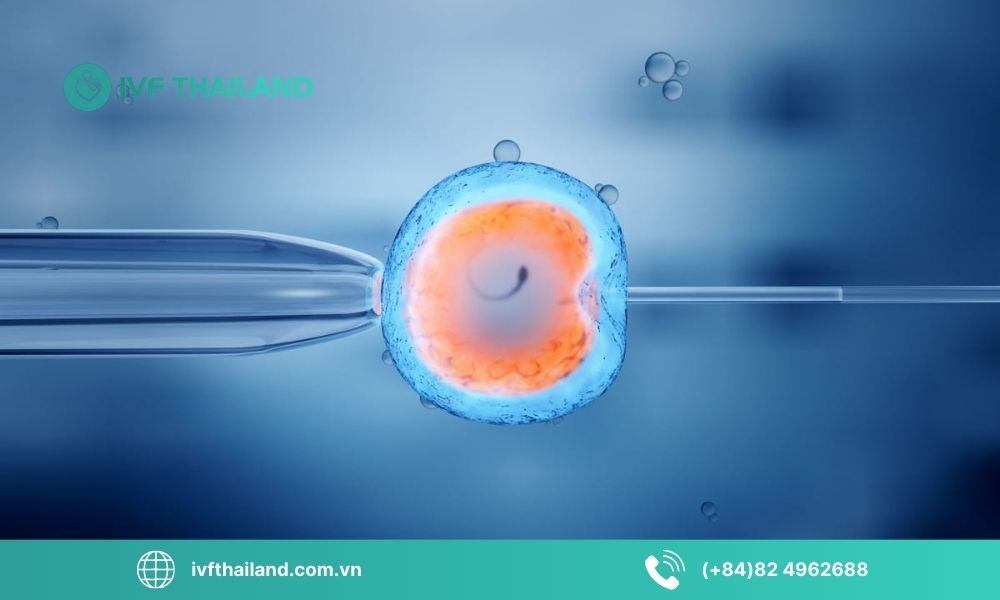 IVF hoạt động như thế nào?