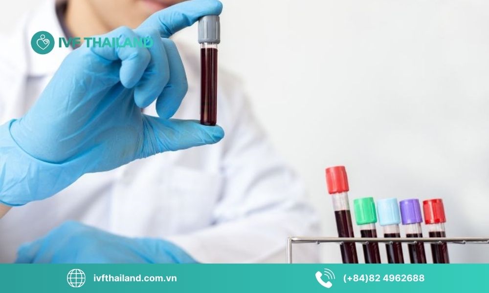 Mục đích của các xét nghiệm trước khi lưu trữ