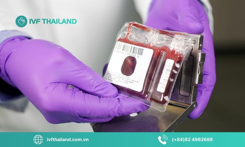 Những lưu ý quan trọng trước khi thực hiện xét nghiệm