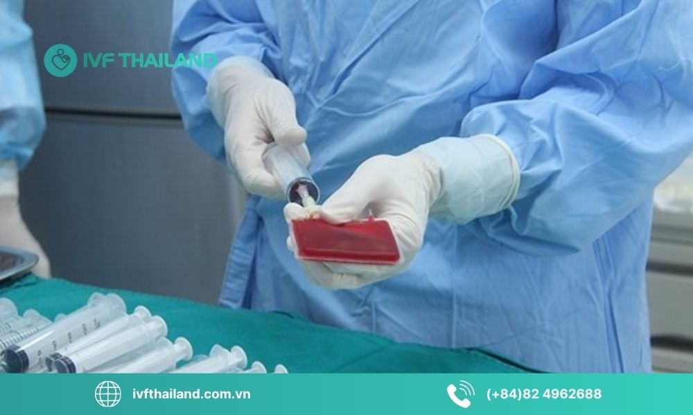 Quy trình lưu trữ tế bào gốc tại Thái Lan