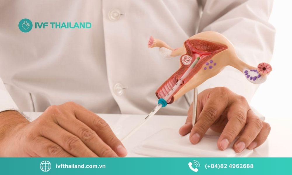 Sai lầm trong chăm sóc và sinh hoạt sau IUI