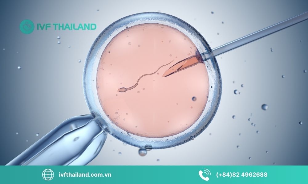 Thụ tinh trong ống nghiệm (IVF)