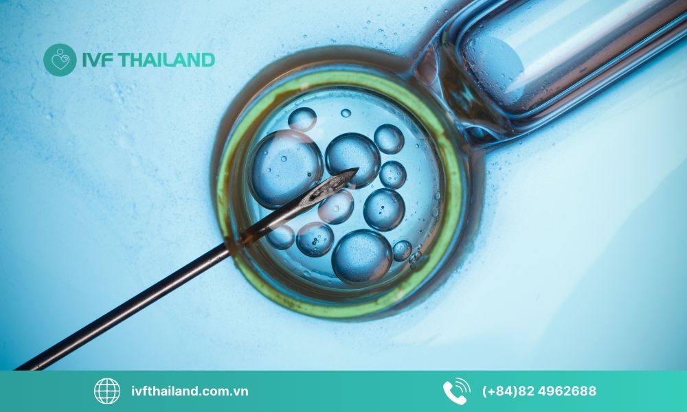 Tổng quan các khoản chi phí trong một chu kỳ IVF