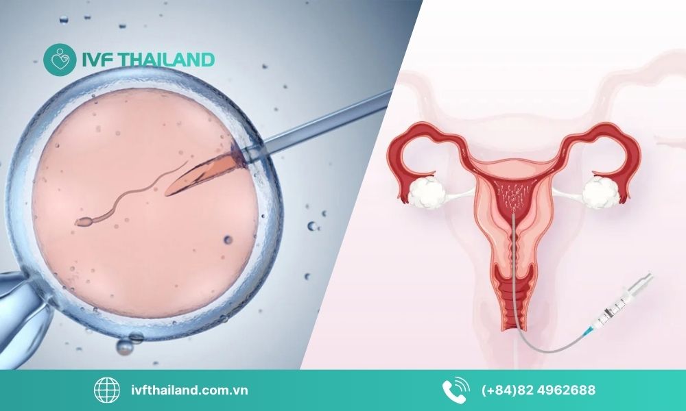Tổng quan về hai phương pháp hỗ trợ sinh sản IVF và IUI